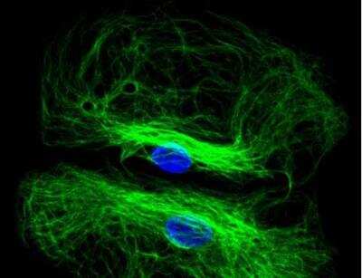 Immunocytochemistry/Immunofluorescence: VECTASHIELD(R) Hard Set(TM) Antifade Mounting Medium with DAPI [H-1500-NB] - Astrocytes: Stained for GFAP and detected with Dylight 488 labeled secondary antibody. Mounted in VECTASHIELD HardSet Mounting Medium with DAPI. Image courtesy of Dr Emma East, Department of Life Sciences, The Open University, U.K.*