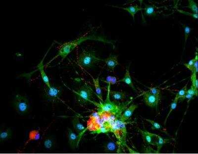 Immunocytochemistry/Immunofluorescence: VECTASHIELD(R) Hard Set(TM) Antifade Mounting Medium with DAPI [H-1500-NB] - Dorsal root ganglia cells (neurons and satellite glia) - double label. BIII tubulin, DyLight 549 labeled secondary antibody (red). S100, DyLight 488 labeled secondary antibody (green). Mounted in VECTASHIELD HardSet Mounting Medium with DAPI.