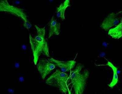 Immunocytochemistry/Immunofluorescence: VECTASHIELD(R) Hard Set(TM) Antifade Mounting Medium with DAPI [H-1500-NB] - Astrocytes: Stained for GFAP and detected with Dylight 488 labeled secondary antibody. Mounted in VECTASHIELD HardSet Mounting Medium with DAPI. Image courtesy of Dr Emma East, Department of Life Sciences, The Open University, U.K.*