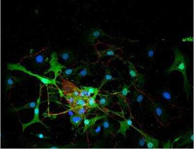 Immunocytochemistry/Immunofluorescence: VECTASHIELD(R) Hard Set(TM) Antifade Mounting Medium with DAPI [H-1500-NB] - Dorsal root ganglia cells (neurons and satellite glia) - double label. BIII tubulin, DyLight 549 labeled secondary antibody (red). S100, DyLight 488 labeled secondary antibody (green). Mounted in VECTASHIELD HardSet Mounting Medium with DAPI.