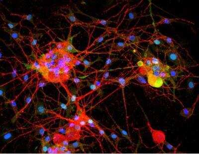 Immunocytochemistry/Immunofluorescence: VECTASHIELD(R) Hard Set(TM) Antifade Mounting Medium with DAPI [H-1500-NB] - Dorsal root ganglia cells (neurons and satellite glia) - double label. BIII tubulin, DyLight 594 labeled secondary antibody (red). S100, DyLight 488 labeled secondary antibody (green). Mounted in VECTASHIELD HardSet Mounting Medium with DAPI.