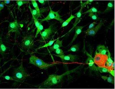 Immunocytochemistry/Immunofluorescence: VECTASHIELD(R) Hard Set(TM) Antifade Mounting Medium with DAPI [H-1500-NB] - Dorsal root ganglia cells (neurons and satellite glia) - double label. BIII tubulin, DyLight 549 labeled secondary antibody (red). S100, DyLight 488 labeled secondary antibody (green). Mounted in VECTASHIELD HardSet Mounting Medium with DAPI.