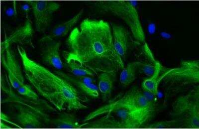 Immunocytochemistry/Immunofluorescence: VECTASHIELD(R) Hard Set(TM) Antifade Mounting Medium with DAPI [H-1500-NB] - Astrocytes: Stained for GFAP and detected with Dylight 488 labeled secondary antibody. Mounted in VECTASHIELD HardSet Mounting Medium with DAPI. Image courtesy of Dr Emma East, Department of Life Sciences, The Open University, U.K.*