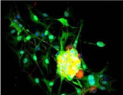 Immunocytochemistry/Immunofluorescence: VECTASHIELD(R) Hard Set(TM) Antifade Mounting Medium with DAPI [H-1500-NB] - Dorsal root ganglia cells (neurons and satellite glia) - double label. BIII tubulin, DyLight 549 labeled secondary antibody (red). S100, DyLight 488 labeled secondary antibody (green). Mounted in VECTASHIELD HardSet Mounting Medium with DAPI.