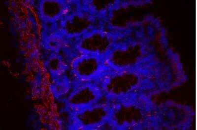 Immunohistochemistry: VECTASHIELD(R) Hard Set(TM) Antifade Mounting Medium with DAPI [H-1500-NB] - Colon: Desmin (m), Biotinylated Horse anti-mouse IgG, Texas Red Avidin DCS (red). Mounted in VECTASHIELD HardSet Mounting Medium with DAPI.