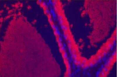 Immunohistochemistry: VECTASHIELD(R) Hard Set(TM) Antifade Mounting Medium with DAPI [H-1500-NB] - Prostate: Prostate Specific Antigen (rp) labeled with fluorescein using the ProtOn Fluorescein Labeling Kit. Fluorescein label detected with Alkaline Phosphatase Anti-Fluorescein and visualized with Vector Red. Mounted in VECTASHIELD HardSet Mounting Medium