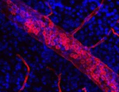 Immunohistochemistry: VECTASHIELD(R) Hard Set(TM) Antifade Mounting Medium with DAPI [H-1500-NB] - Retina from mice, perfused with DyLight 594-LEL. The retina were sectioned and mounted in Vectashield HardSet+DAPI. Image courtesy of George W. Smith, Florida Atlantic University