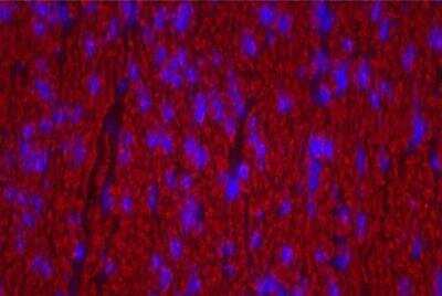 Immunohistochemistry: VECTASHIELD(R) Hard Set(TM) Antifade Mounting Medium with DAPI [H-1500-NB] - Colon: Desmin (m), Biotinylated Horse anti-mouse IgG, Texas Red Avidin DCS (red). Mounted in VECTASHIELD HardSet Mounting Medium with DAPI.