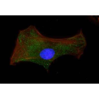 Immunocytochemistry/Immunofluorescence: VECTASHIELD(R) Hard Set(TM) Antifade Mounting Medium with Phalloidin [H-1600-NB] - Mouse embryonal fibroblasts: Anti-Cytokeratin (m) detected with DyLight 488 Anti-Mouse IgG, mounted in a 1:1 mixture of VECTASHIELD HardSet Mounting Medium with DAPI and VECTASHIELD HardSet Mounting Medium with TRITC-Phalloidin.