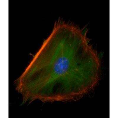 Immunocytochemistry/Immunofluorescence: VECTASHIELD(R) Hard Set(TM) Antifade Mounting Medium with Phalloidin [H-1600-NB] - Mouse embryonal fibroblasts: Anti-Clathrin (m) detected with DyLight 488 Anti-Mouse IgG, mounted in a 1:1 mixture of VECTASHIELD HardSet Mounting Medium with DAPI and VECTASHIELD HardSet Mounting Medium with TRITC-Phalloidin.