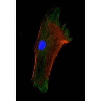 Immunocytochemistry/Immunofluorescence: VECTASHIELD(R) Hard Set(TM) Antifade Mounting Medium with Phalloidin [H-1600-NB] - Mouse embryonal fibroblasts: Anti-Cytokeratin (m) detected with DyLight 488 Anti-Mouse IgG, mounted in a 1:1 mixture of VECTASHIELD HardSet Mounting Medium with DAPI and VECTASHIELD HardSet Mounting Medium with TRITC-Phalloidin.