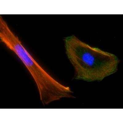 Immunocytochemistry/Immunofluorescence: VECTASHIELD(R) Hard Set(TM) Antifade Mounting Medium with Phalloidin [H-1600-NB] - Mouse embryonal fibroblasts: Anti-Clathrin (m) detected with DyLight 488 Anti-Mouse IgG, mounted in a 1:1 mixture of VECTASHIELD HardSet Mounting Medium with DAPI and VECTASHIELD HardSet Mounting Medium with TRITC-Phalloidin.