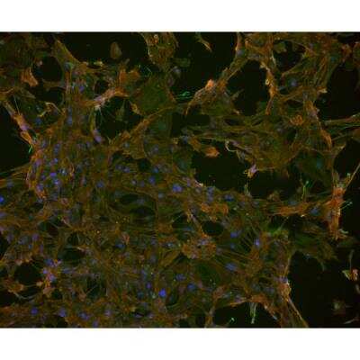 Immunocytochemistry/Immunofluorescence: VECTASHIELD(R) Hard Set(TM) Antifade Mounting Medium with Phalloidin [H-1600-NB] - Mouse embryonal fibroblasts: Anti-Cytokeratin (m) detected with DyLight 488 Anti-Mouse IgG, mounted in a 1:1 mixture of VECTASHIELD HardSet Mounting Medium with DAPI and VECTASHIELD HardSet Mounting Medium with TRITC-Phalloidin.