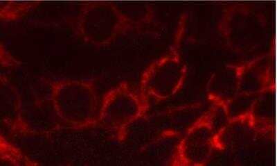 Immunocytochemistry/Immunofluorescence: VECTASHIELD(R) HardSet(TM) Antifade Mounting Medium [H-1400-NB] - VECTASHIELD(R) Hardset(TM) Antifade Mounting Medium [H-1400-NB] - C6 rat glioma cells: Antibody to mitochondria localized with Alexa Fluor 555 labeled secondary antibody. Mounted in VECTASHIELD HardSet Mounting Medium. Photo taken after 15 minutes of irradiation under mercury vapor light source.