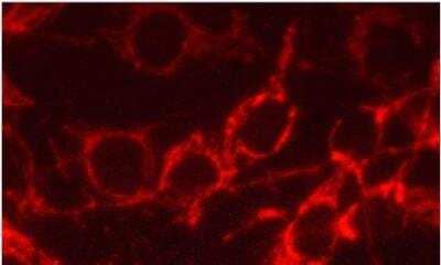 Immunocytochemistry/Immunofluorescence: VECTASHIELD(R) HardSet(TM) Antifade Mounting Medium [H-1400-NB] - VECTASHIELD(R) Hardset(TM) Antifade Mounting Medium [H-1400-NB] - C6 rat glioma cells: Antibody to mitochondria localized with Alexa Fluor 555 labeled secondary antibody. Mounted in VECTASHIELD HardSet Mounting Medium. Image provided courtesy of Chandler Fulton and Jennifer Stella, Department of Biology, Brandeis University.