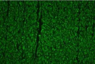 Immunohistochemistry: VECTASHIELD(R) Hardset(TM) Antifade Mounting Medium [H-1400-NB] - Colon: Desmin (m), Biotinylated Horse anti-mouse IgG, Fluorescein Avidin DCS (green). Mounted in VECTASHIELD HardSet Mounting Medium.