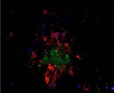 Immunohistochemistry: VECTASHIELD(R) Hardset(TM) Antifade Mounting Medium [H-1400-NB] -  Alzheimer's disease mouse brain model - double label: glial cells stained with Iba1 (rp) followed by DyLight 594 Goat Anti-Rabbit IgG (DI-1594); plaques stained with Biotinylated Mouse Anti-Human Amyloid Beta followed by DyLight 488 Streptavidin (SA-548)