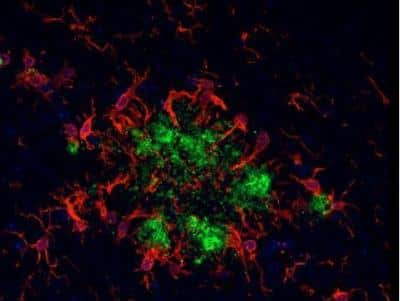 Immunohistochemistry: VECTASHIELD(R) Hardset(TM) Antifade Mounting Medium [H-1400-NB] - Alzheimer's disease mouse brain model - double label: glial cells stained with Iba1 (rp) followed by DyLight 594 Goat Anti-Rabbit IgG (DI-1594); plaques stained with Biotinylated Mouse Anti-Human Amyloid Beta followed by DyLight 488 Streptavidin (SA-5488)