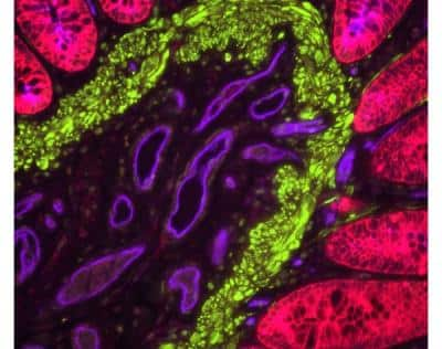 VECTASHIELD(R) PLUS Antifade Mounting Medium [H-1900-10-NB] - Human colon tissue section. Stained with rabbit anti-cytokeratin (AE1/AE3) and mouse anti-desmin Abs, detected simultaneously with VectaFluor Duet Double Labeling Kit. Vasculature detected using DyLight 649 UEA I lectin (purple). Mounted in VECTASHIELD PLUS.