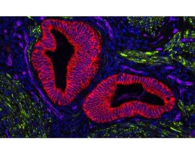 VECTASHIELD® Vibrance(TM) Antifade Mounting Medium with DAPI [H-1800-10-NB] - Human FFPE Uterine tissue section. Stained with Desmin (green) and Cytokeratin (red) using VectaFluor(TM) Duet Double Labeling Kit and vasculature usind DyLight 649 UEA I lectin (purple). Mounted in VECTASHIELD Vibrance with DAPI (blue).