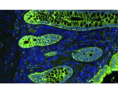 VECTASHIELD® Vibrance(TM) Antifade Mounting Medium with DAPI [H-1800-10-NB] - Human FFPE colon tissue section stained for cytokeratin (green) using fluorescein anti-mouse IgG secondary Ab. Mounted in VECTASHIELD Vibrance Antifade Mounting Medium with DAPI (blue).