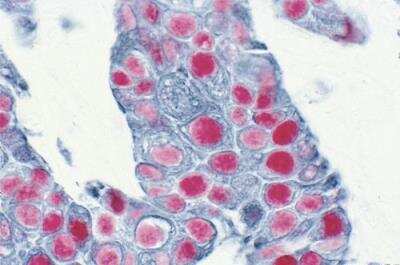 Immunohistochemistry: VECTASTAIN(R) ABC AP Detection Kit [AK-5000-NB] - VECTASTAIN(R) ABC-AP Staining Kit (Alkaline Phosphatase, Standard)