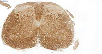 Immunohistochemistry: VECTASTAIN(R) ABC anti-Mouse IgG HRP Immunodetection Kit [PK-4002-NB] - Mouse Spinal Cord. Primary antibody: Anti-Myelin Basic Protein Mouse mAb. Detection: VECTASTAIN(R) ABC anti-Mouse IgG HRP Immunodetection Kit and DAB. Image from verified customer review.