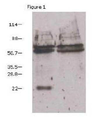 Immunoprecipitation: VEGF Antibody (6B7) [NBP1-19181] - HUVEC lysate immunoprecipitated with 2ug antibody.