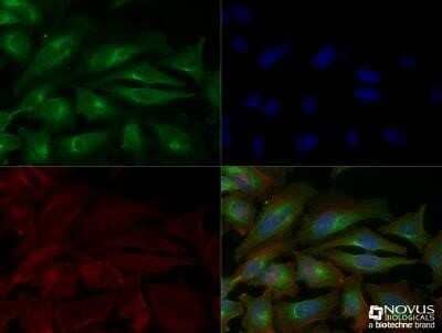 HeLa cells were fixed for 10 minutes using 10% formalin and then permeabilized for 5 minutes using 1X TBS + 0.5% Triton X-100. The cells were incubated with anti-VEGF (VG1) [NB100-664] at 1:200 overnight at 4C and detected with an anti-mouse DyLight 488 (Green) at 1:500. Actin was detected with Phalloidin 568 (Red) at a 1:200 dilution. Nuclei were counterstained with DAPI (Blue). Cells were imaged using a 40X objective. Image from the standard format of this antibody.