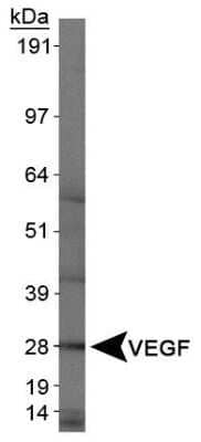 Analysis of VEGF in human kidney protein using NB100-664. Image from the standard format of this antibody.