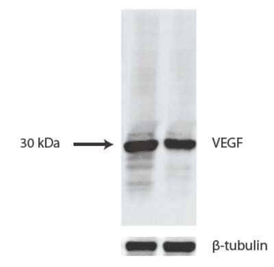 HUVEC and 293T cells transfected with a plasmid expressing human VEGF165 at 1:1000. Image provided by verified customer review. Image from the standard format of this antibody.