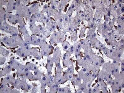 Immunohistochemistry: VEGF-C Antibody (OTI4A1) - Azide and BSA Free [NBP2-74845] - Staining of paraffin-embedded Human liver tissue within the normal limits using anti-VEGFC mouse monoclonal antibody. (Heat-induced epitope retrieval by 1mM EDTA in 10mM Tris buffer (pH8.5) at 120C for 3min) (1:150)