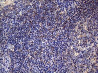 Immunohistochemistry: VEGF-C Antibody (OTI4A1) - Azide and BSA Free [NBP2-74845] - Staining of paraffin-embedded Human tonsil within the normal limits using anti-VEGFC mouse monoclonal antibody. (Heat-induced epitope retrieval by 1mM EDTA in 10mM Tris buffer (pH8.5) at 120C for 3min) (1:150)