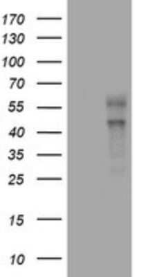Western Blot: VEGF-C Antibody (OTI4A1) - Azide and BSA Free [NBP2-74845] - Analysis of HEK293T cells were transfected with the pCMV6-ENTRY control (Left lane) or pCMV6-ENTRY VEGF-C.