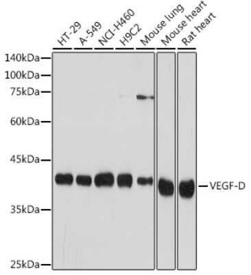 Western Blot: VEGF-D Antibody (9C2U7) [NBP3-15705] - Western blot analysis of extracts of various cell lines, using VEGF-D antibody (NBP3-15705) at 1:1000 dilution. Secondary antibody: HRP Goat Anti-Rabbit IgG (H+L) at 1:10000 dilution. Lysates/proteins: 25ug per lane. Blocking buffer: 3% nonfat dry milk in TBST. Detection: ECL Basic Kit. Exposure time: 10s.