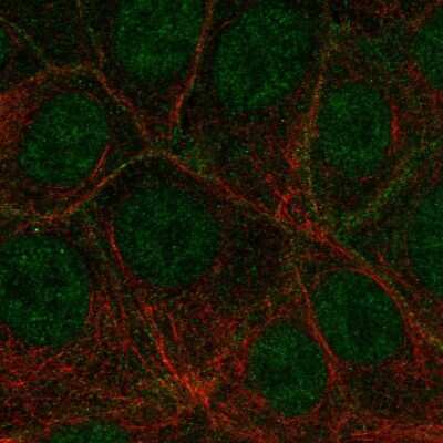 Immunocytochemistry/Immunofluorescence: VEGF R3/Flt-4 Antibody [NBP2-68669] - Staining of human cell line MCF7 shows localization to nucleoplasm & plasma membrane.