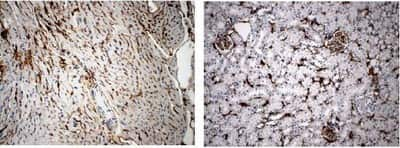 Immunohistochemistry-Paraffin: VEGF Receptor 3 Antibody (RM0003-5F63) [NB110-61018] - 4% PFA fixed mouse heart and kidney tissue sections were subjected to IHC with rat anti mouse VEGFR3 (RM0003-5F63).