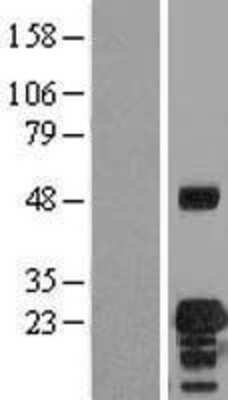 Western Blot: VEGFB Overexpression Lysate (Adult Normal) [NBL1-17713] Left-Empty vector transfected control cell lysate (HEK293 cell lysate); Right -Over-expression Lysate for VEGFB.