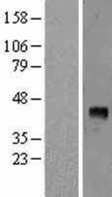 Western Blot: VEGFD Overexpression Lysate (Adult Normal) [NBL1-10722] Left-Empty vector transfected control cell lysate (HEK293 cell lysate); Right -Over-expression Lysate for VEGFD.