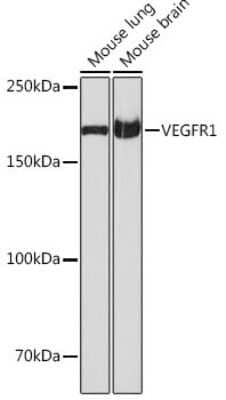 Western Blot: VEGFR1/Flt-1 Antibody (7F1A3) [NBP3-15683] - Western blot analysis of extracts of various cell lines, using VEGFR1/Flt-1 antibody (NBP3-15683) at 1:1000 dilution. Secondary antibody: HRP Goat Anti-Rabbit IgG (H+L) at 1:10000 dilution. Lysates/proteins: 25ug per lane. Blocking buffer: 3% nonfat dry milk in TBST. Detection: ECL Basic Kit. Exposure time: 1s.