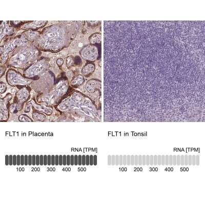 Immunohistochemistry-Paraffin: VEGFR1/Flt-1 Antibody (CL0344) [NBP2-52919] - Staining in human placenta and tonsil tissues. Corresponding FLT1 RNA-seq data are presented for the same tissues.