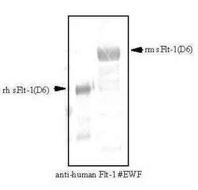 Western Blot: VEGFR1/Flt-1 Antibody (EWF) [NB600-1006] - VEGF Receptor 1 Antibody (EWF) [NB600-1006] - The monoclonal anti-human VEGFR-1/Flt-1 cross reacts with recombinant murine sFlt-1.