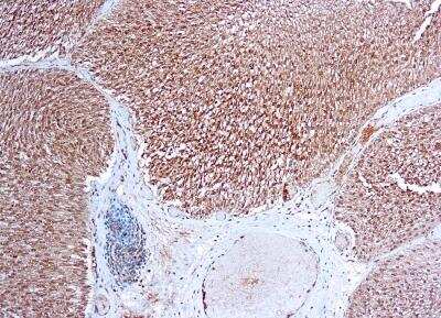 Immunohistochemistry-Paraffin: VEGFR1/Flt-1 Antibody [NB100-685] - Formalin fixed paraffin embedded human placenta stained with VEGFR1/Flt-1 antibody (NB100-685).