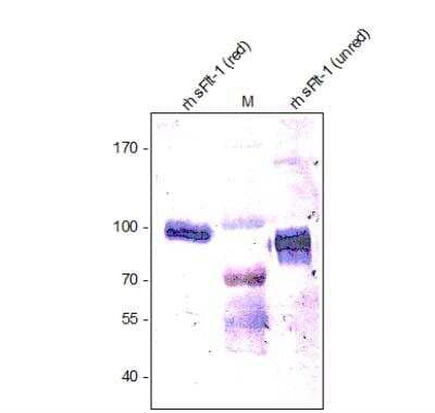 Western Blot: VEGFR1/Flt-1 Antibody [NB600-1007] - Analysis of recombinant human soluble VEGFR-1/Flt-1 using a polyclonal antibody directed against the extracellular domain of human VEGFR-1.