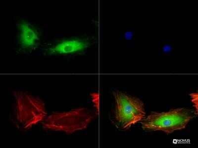 Immunocytochemistry/Immunofluorescence: VEGFR2/KDR/Flk-1 Antibody (1B6) - Azide and BSA Free [NBP2-81008] - Detection in HUVEC cells at 1:50 Image from the standard format of this antibody.