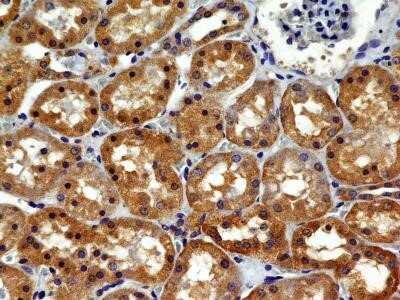 Immunohistochemistry-Paraffin: VEGFR2/KDR/Flk-1 Antibody (1B6) - Azide and BSA Free [NBP2-81008] - Analysis of FFPE tissue section of human normal kidney with mouse monoclonal VEGF R2/KDR/Flk-1 antibody (clone 1B6) at 5 ug/ml concentration. The cuboidal epithelial cells of of various tubules/ducts showed a specific cytoplasmic immunopositivity of prote