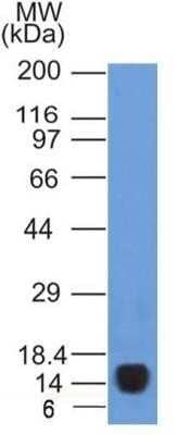 Western Blot: VEGFR2/KDR/Flk-1 Antibody (1B6) - Azide and BSA Free [NBP2-81008] - Analysis of VEGF R2/KDR/Flk-1 (1B6) in purified human recombinant protein. Image from the standard format of this antibody.