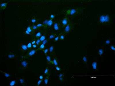 Immunocytochemistry/Immunofluorescence: VEGFR2/KDR/Flk-1 Antibody (20I6) - Azide and BSA Free [NBP1-18646] - HMEC-1 CRL-3243 cells, stained with 1:50 VEGFR2/KDR/Flk-1 antibody (NBP1-18645AF488) (green) and DAPI (blue). Image from verified customer review.