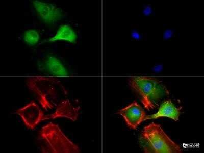 Immunocytochemistry/Immunofluorescence: VEGFR2/KDR/Flk-1 Antibody (2C6) - Azide and BSA Free [NBP2-81009] - Antibody (1:50) was tested in HUVEC cells with DyLight 488 (green). Nuclei and alpha-tubulin were counterstained with DAPI (blue) and DyLight 550 (red). Image from the standard format of this antibody.