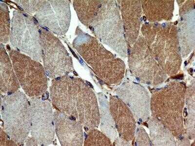 Immunohistochemistry: VEGFR2/KDR/Flk-1 Antibody (2C6) - Azide and BSA Free [NBP2-81009] - Aanalysis of FFPE transverse section of normal human skeletal muscle with antibody at 5 ug/ml concentration. The myocytes showed a moderate diffused to granular staining in the cytoplasm. Image from the standard format of this antibody.